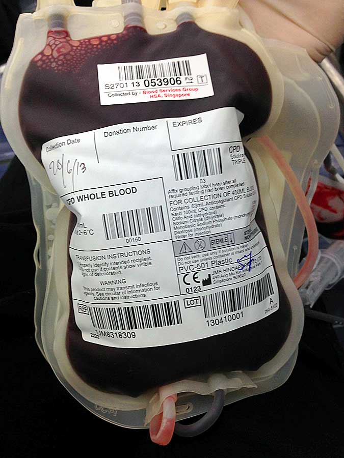 Blood bag filled